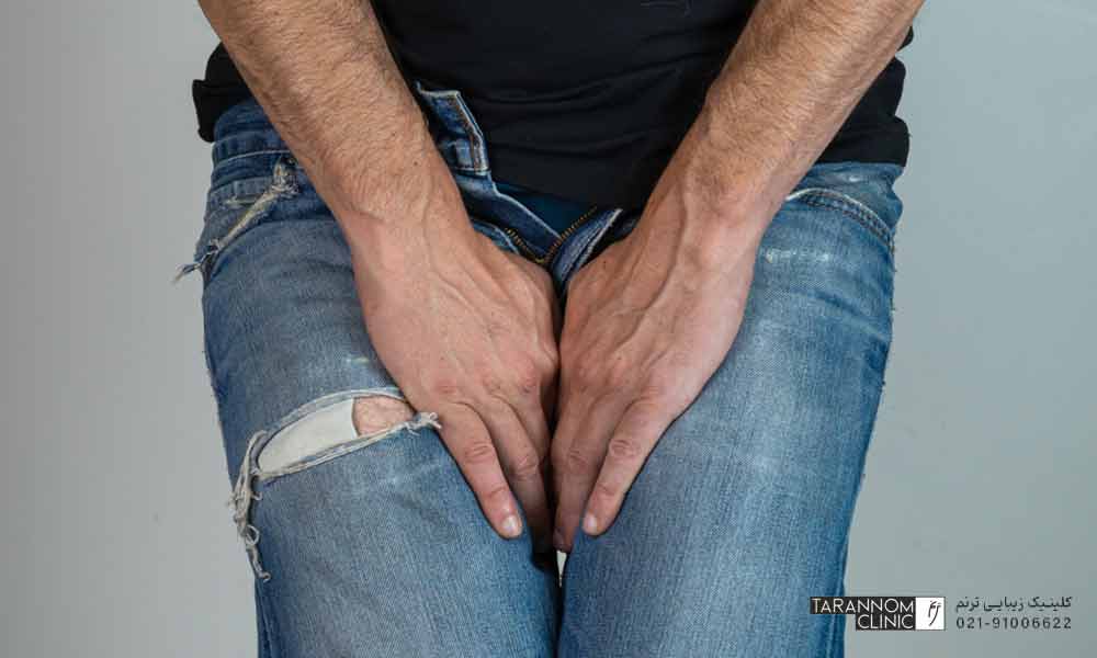 تصویر مردی که دست‌هایش را بر ناحیه شرمگاهی خود قرار داده است - رابطه جنسی بعد از درمان زگیل تناسلی