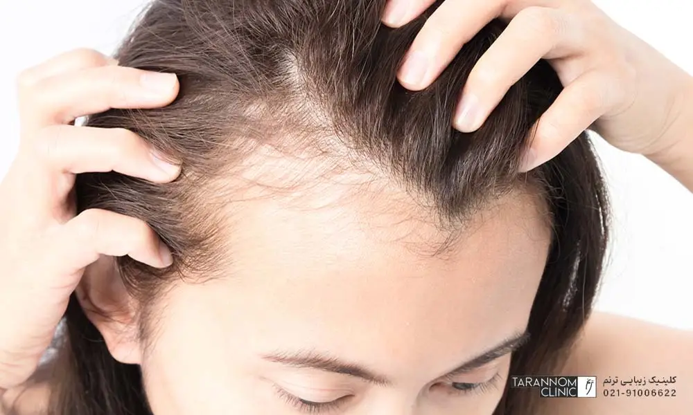 چگونه مو‌های خود را درمان کنیم؟