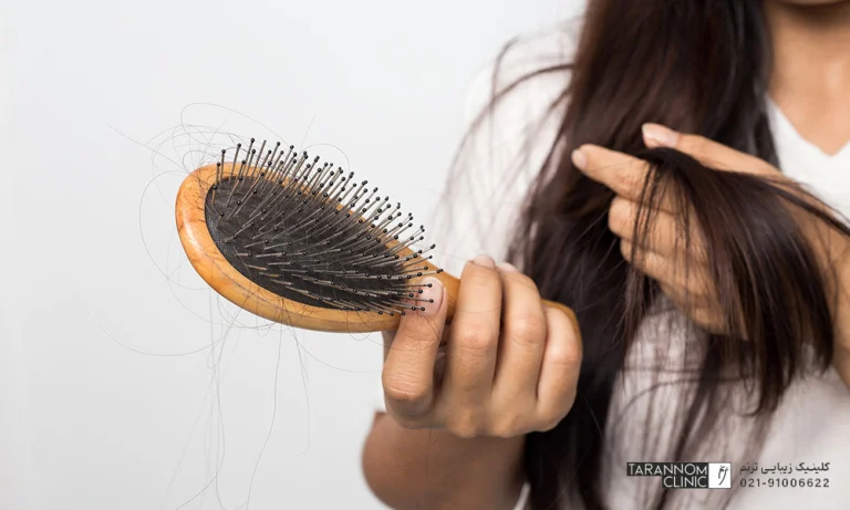 برای جلوگیری از ریزش مو چه عذاهایی مصرف کنیم ؟
