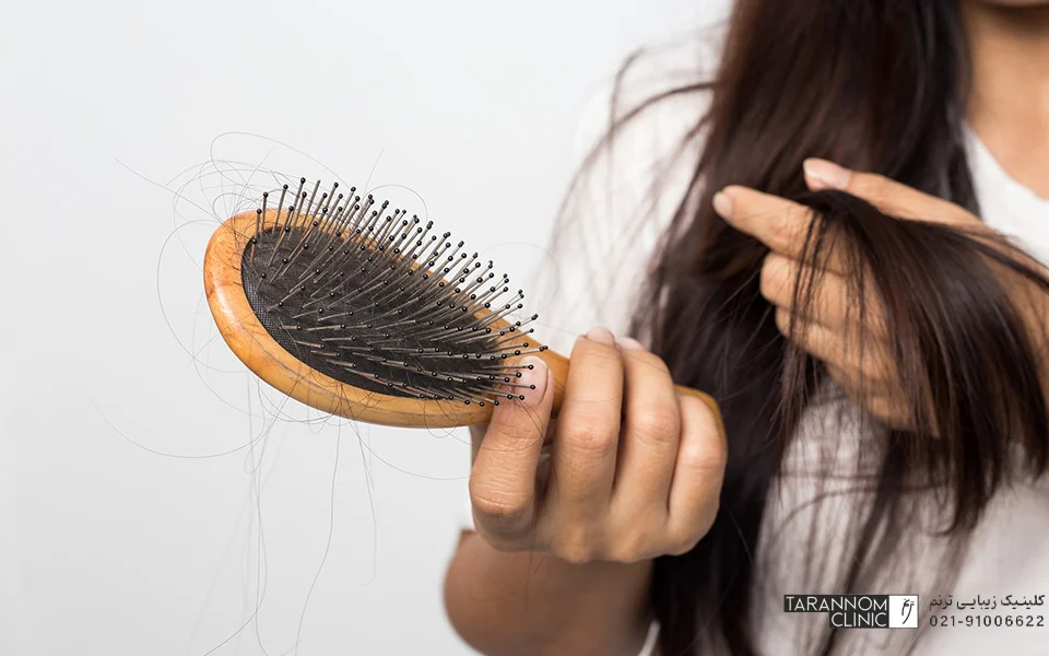 برای جلوگیری از ریزش مو چه عذاهایی مصرف کنیم ؟