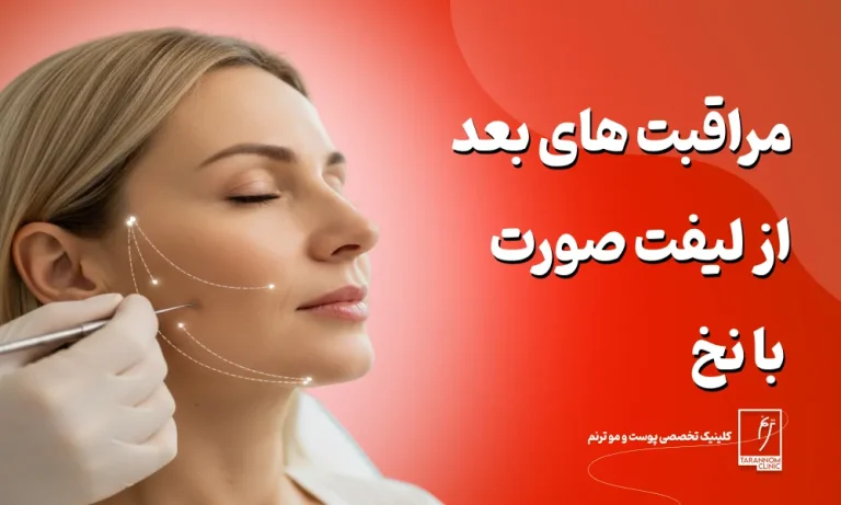 مراقبت های بعد از لیفت صورت با نخ
