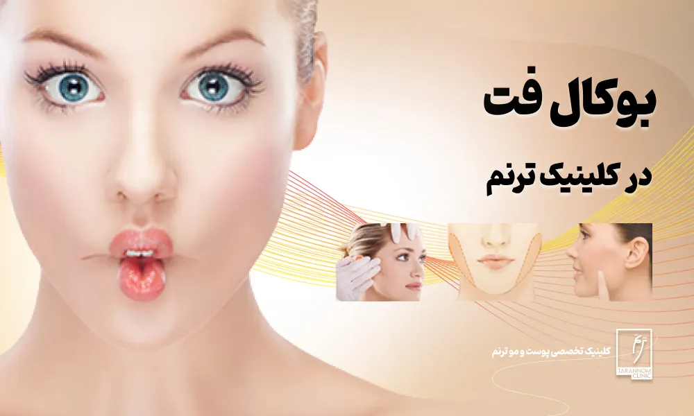 جراحی بوکال فت در کلینیک ترنم