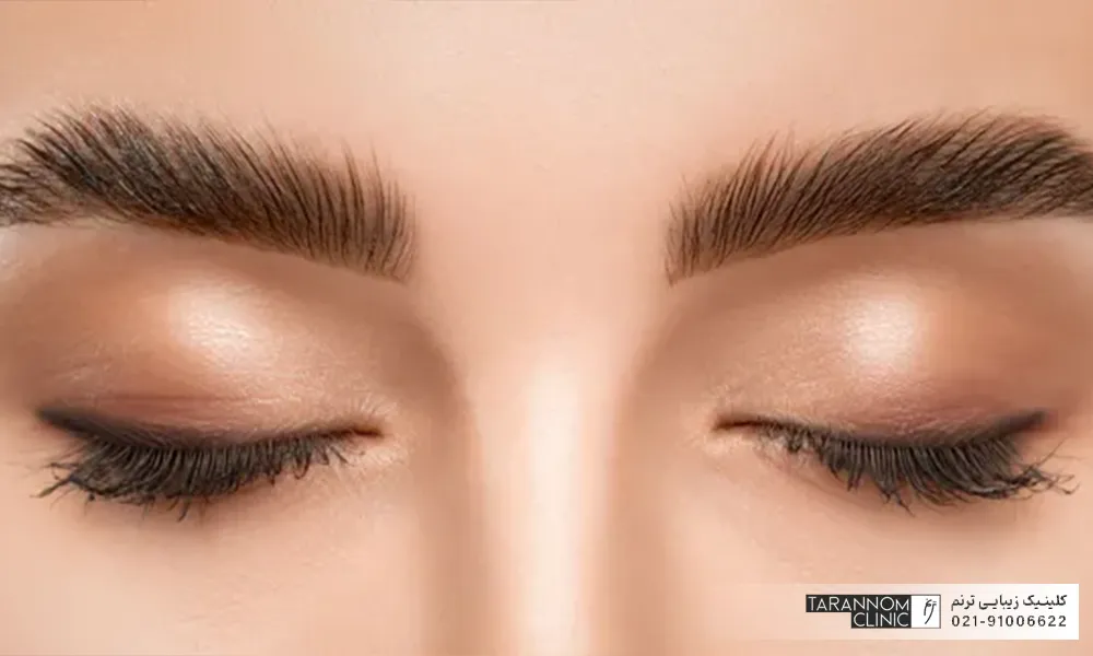 دختری که چشمان خود را بسته است و ابروهای کاشته شده او ضخیم و متراکم است