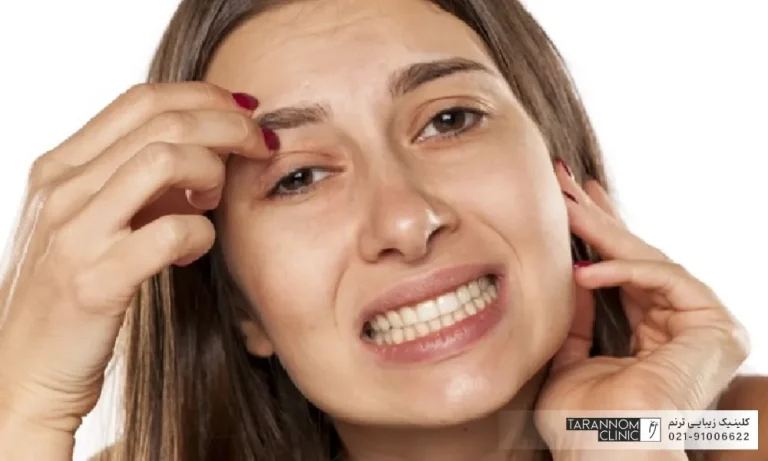 خانمی که از خارش ابروهای خود خسته شده است