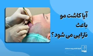 آیا کاشت مو باعث نازایی می شود؟