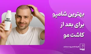 بهترین شامپو برای بعد از کاشت مو