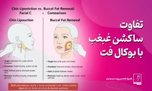 تفاوت ساکشن غبغب با بوکال فت