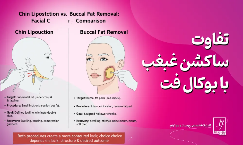 تفاوت ساکشن غبغب با بوکال فت