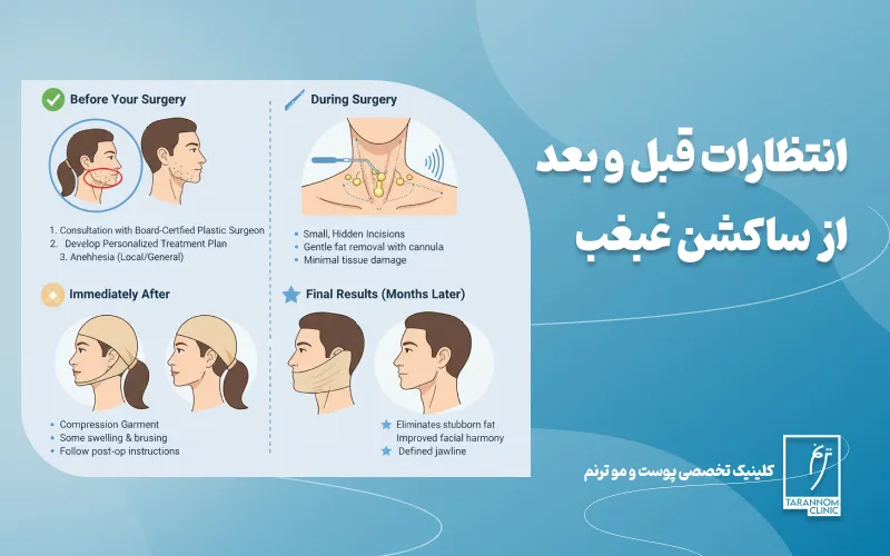 انتظارات قبل و بعد از ساکشن غبغب