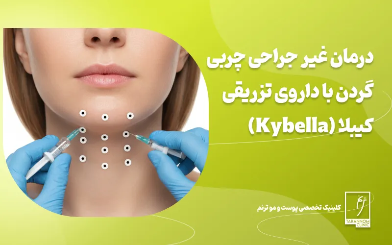 درمان غیر جراحی چربی گردن با داروی تزریقی کیبلا (Kybella)