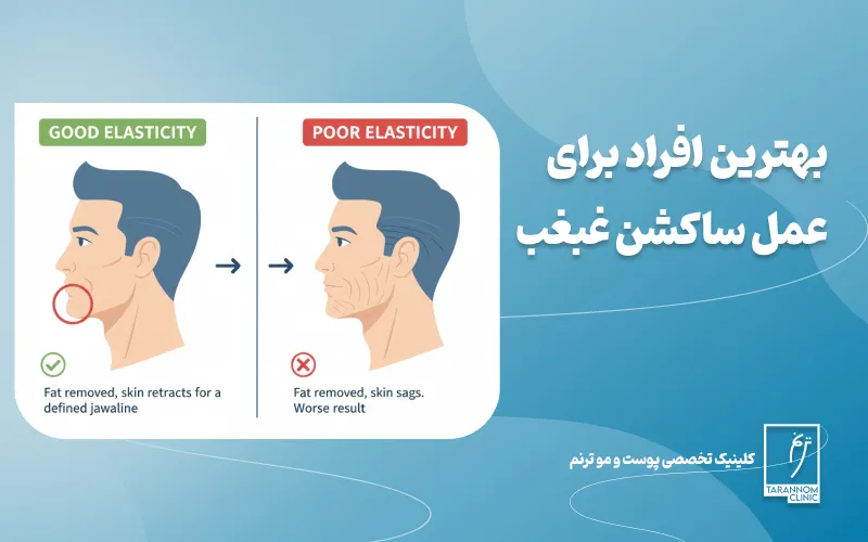 پوست شما خاصیت ارتجاعی خوبی دارد بهترین افراد برای عمل ساکشن غبغب