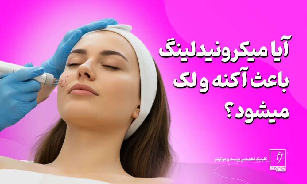 آیا میکرونیدلینگ باعث بروز جوش می شود؟