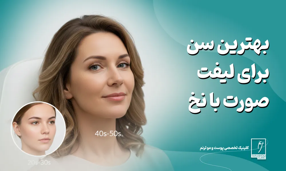 بهترین سن مناسب برای لیفت صورت با نخ